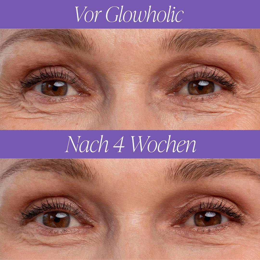 Glowholic Anti-Falten Micro-Needling Infusion Patches (GESCHENK)