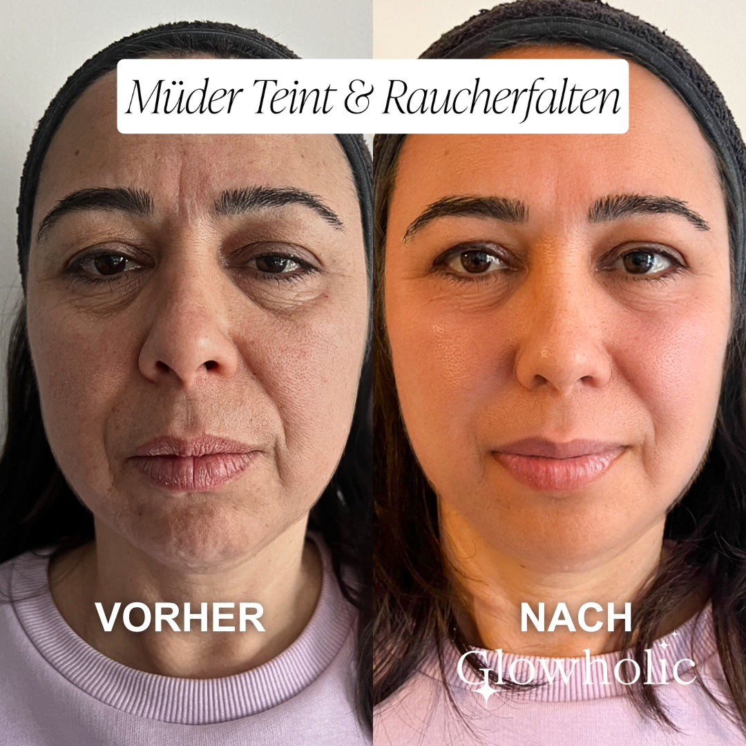 Glowholic Vitamin C Glow Booster