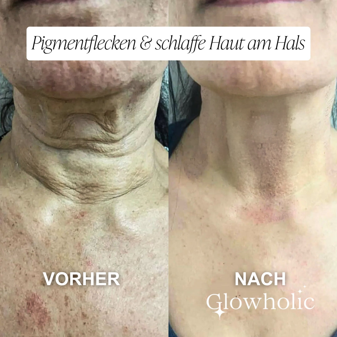 Glowholic Vitamin C Glow Booster