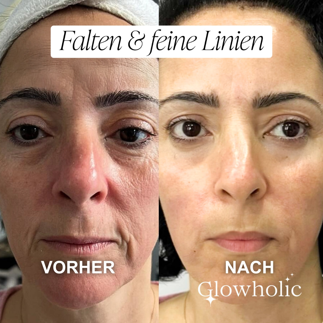 Glowholic Vitamin C Glow Booster