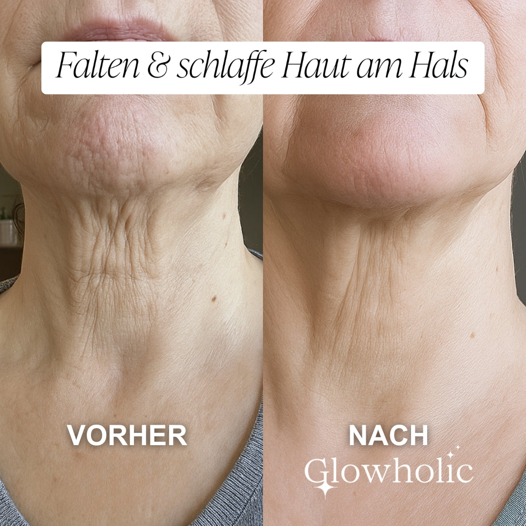Herbst Anti-Falten Starter Set - Glowholic Micro-Needling Infusion