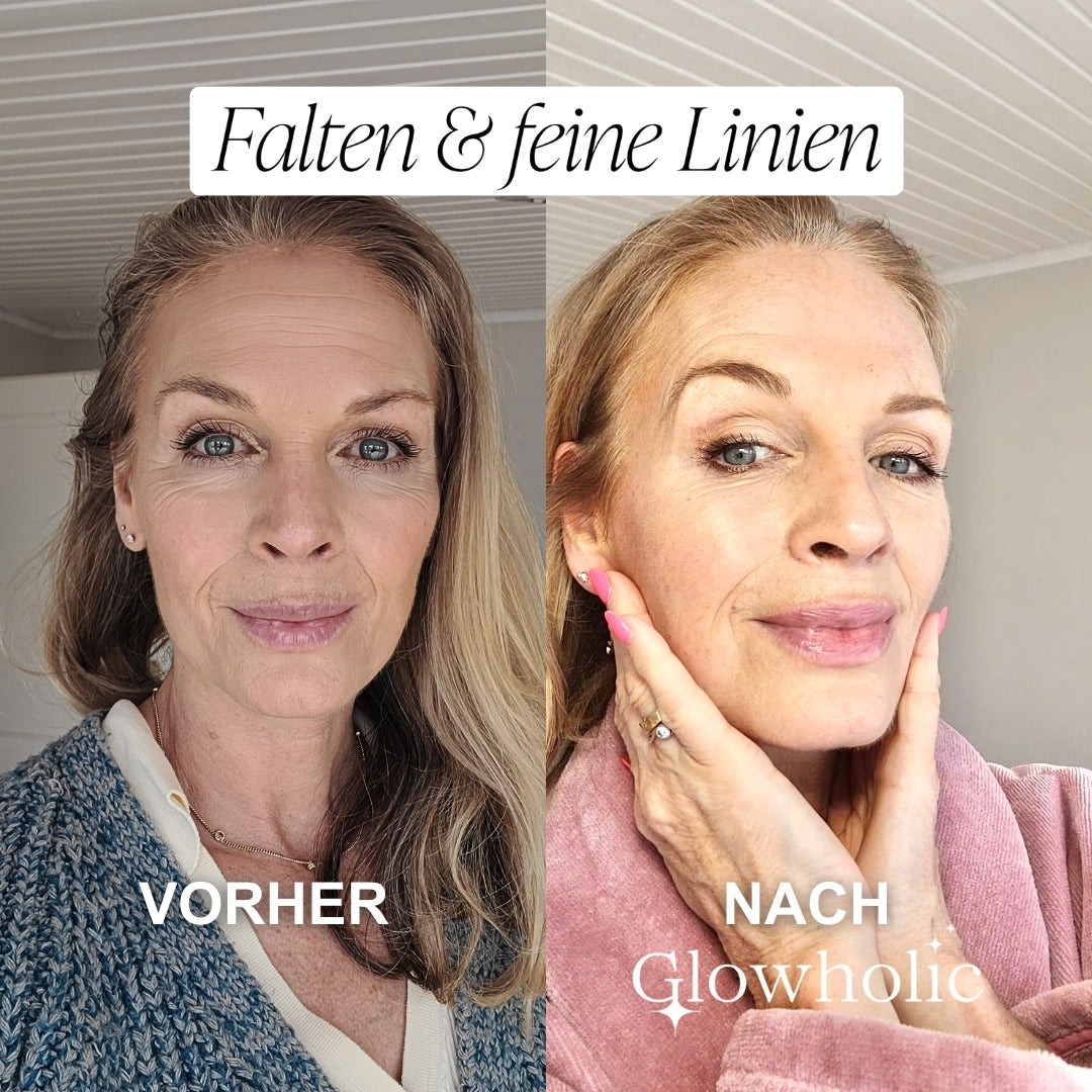 Glowholic Anti-Falten Micro-Needling Infusion Patches