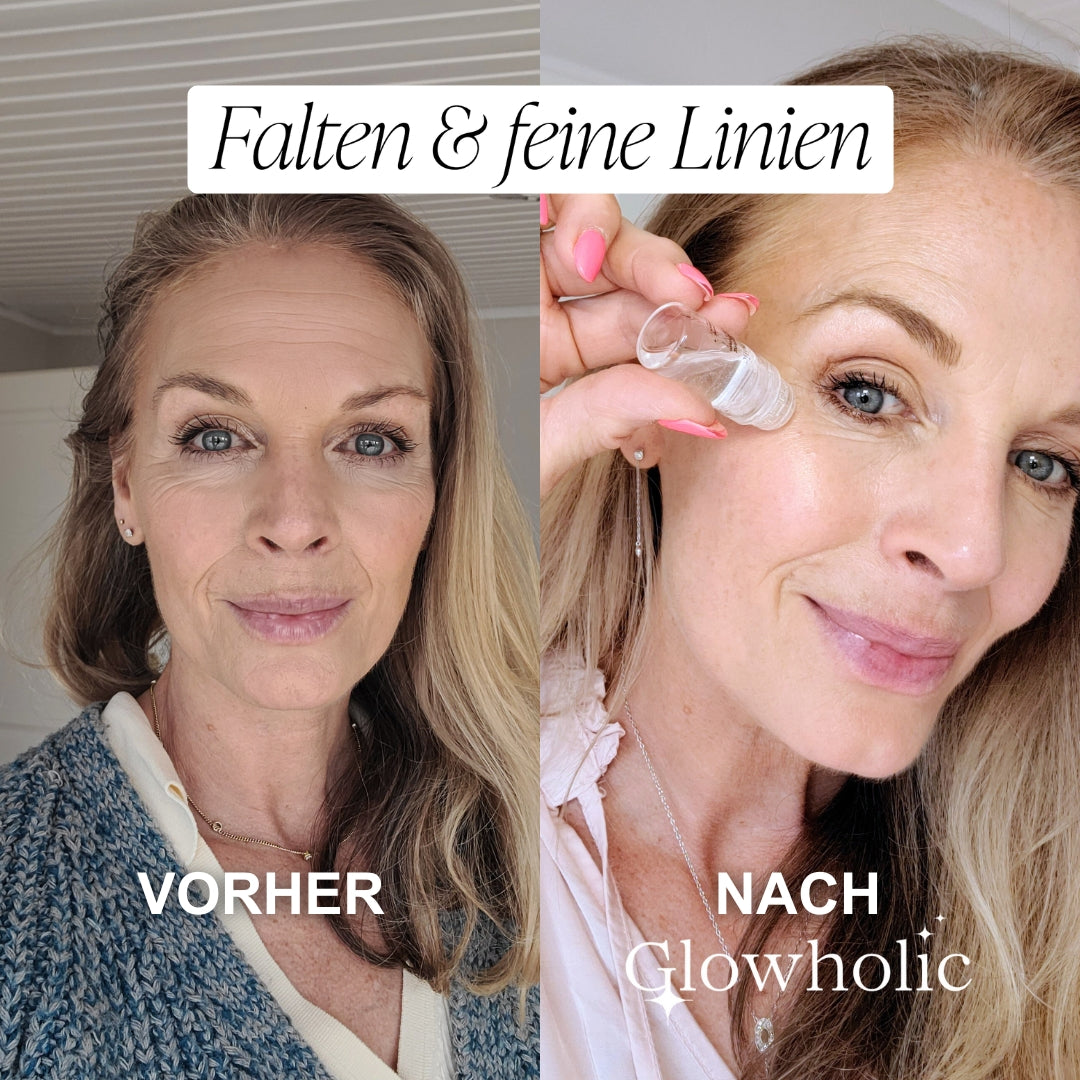 Sommer Anti-Falten Starter Set - Glowholic Micro-Needling-Infusion