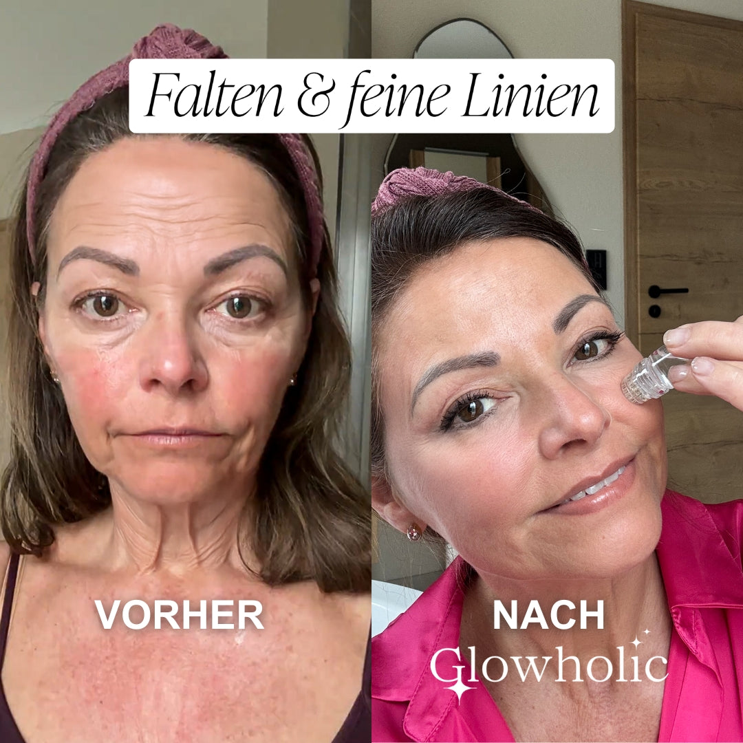 Sommer Anti-Falten Starter Set - Glowholic Micro-Needling-Infusion