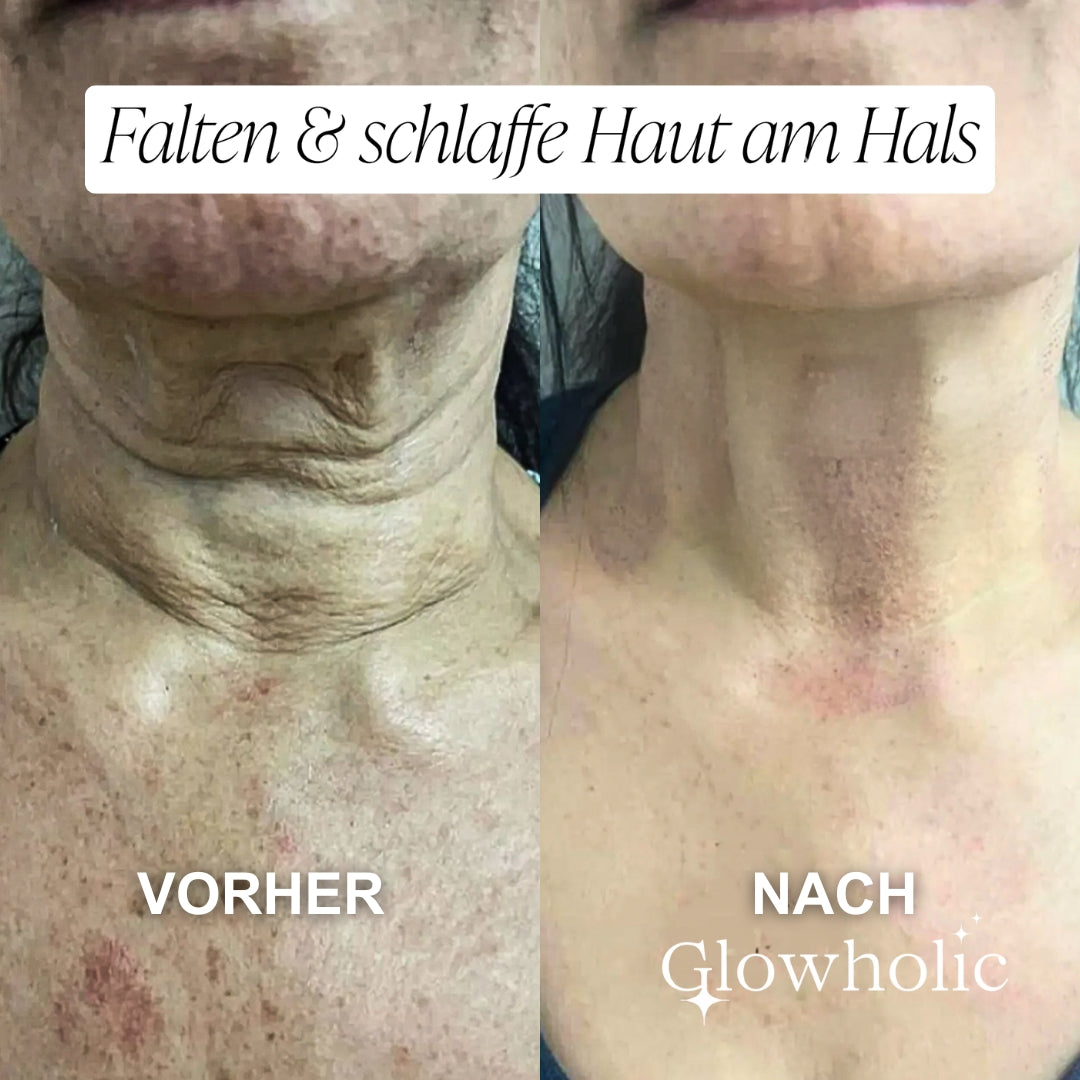 Glowholic Pre-Treatment Anti-Aging Cleanser Mousse – Für die Pflege vor der Micro-Needling-Infusion